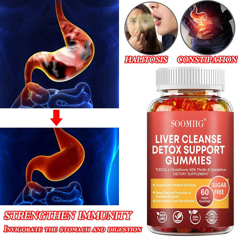 Soomiig Liver Cleanse Detox Gummies with Milk Thistle Extract and Nutrients for Liver Purification and Detoxification - Vibrant Variety Store