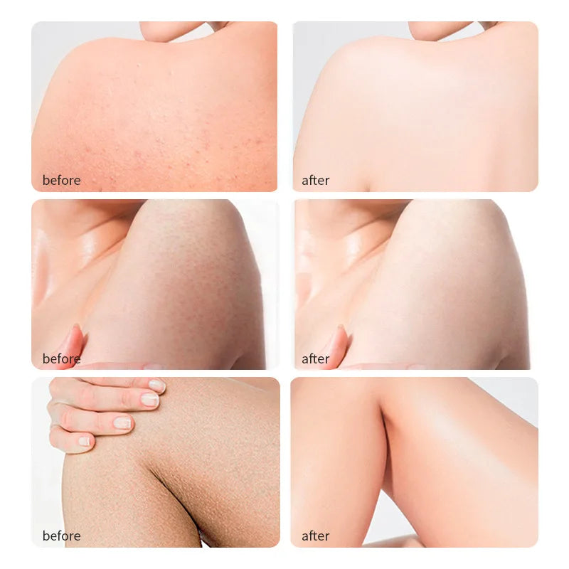 100 Percent Pure Natural Cold Pressed Castor Oil for Healthy Skin and Hair Thickens Eyebrows and Extends Eyelashes 237ml - Vibrant Variety Store